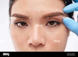 Fox eye surgery hi-res stock photography and images