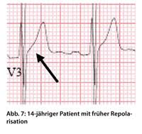 Ekg Interpretation Was Ist Bei Kindern Anders Doctors Today
