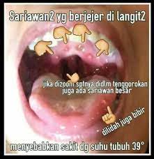 We did not find results for: Sakit Radang Tenggorokan Krn Meriana Kutus Kutus Facebook