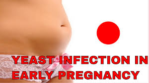 How Do I Avoid A Yeast Infection In Early Pregnancy Get Rid Of Yeast Infection During Pregnancy Youtube