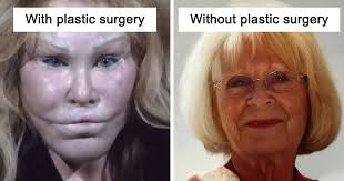 And endured pneumonia and plastic surgery in later life which . Io Gbxpdqhc1wm