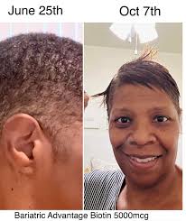 Las Vegas Bariatrics Group