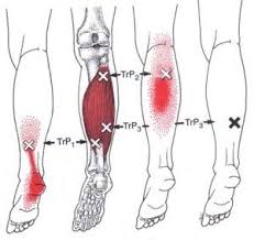 Pin On Health