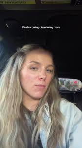 Effective Stretch Marks Removal Techniques with Laser Treatment