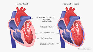 Image result for CHF Observation Unit