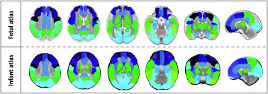 Image result for Mohria marginalis