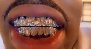 It was released on may 22, 2020, as the second single from migos' upcoming fourth studio album culture iii.produced by buddah bless, the song samples get in my car by 50 cent. Quavo Just Got The World S First Emerald Cut Grill Hip Hop Lately