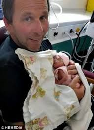 Prematura de 500 gramas agarra mão da própria mãe em batalha pela vida