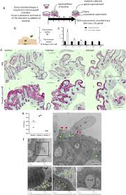 There are over 2,000 various groupings (serovars) that comprise s. Salmonella Typhi Colonization Provokes Extensive Transcriptional Changes Aimed At Evading Host Mucosal Immune Defense During Early Infection Of Human Intestinal Tissue Ebiomedicine