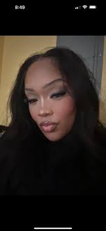 My daughter Milan just passed away last Sunday. She has secondary adrenal  insufficiency due to a brain tumor that she had removed almost 2 years ago.  Look like everything was going so