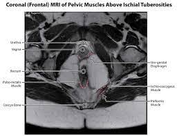 The tendon of the subscapularis muscle attaches both to the lesser tubercle aswell as to the greater tubercle giving support to the long head of the biceps in. Mri Anatomy Pelvis Anatomy Drawing Diagram