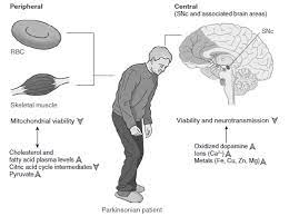 Dec 01, 2002 · abstract. Parkinson S Disease Pathophysiology Of Parkinson S Disease And Metabolic Alterations Metabolism Of Human Diseases