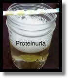 Image result for Isolated Proteinuria