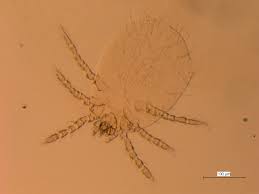 Image result for Trombicula autumnalis