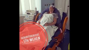Wie sind eure erfahrungen mit der geburtseinleitung? Geburtsbericht Eipolablosung Einleitung Youtube