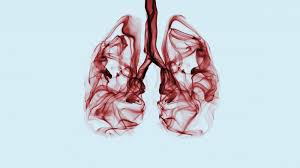 Copd is a term used for a group of obstructive lung diseases. This Woman Thought She Had Pneumonia But Had Lung Cancer Health Com