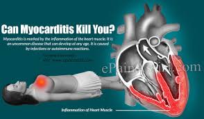 That makes it harder for the heart to pump blood. Can Myocarditis Kill You