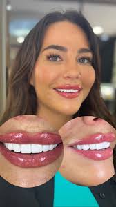 Dental Cosmetic Kusadasi