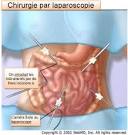 Douleur au clon - Dfinition - Sant-Mdecine