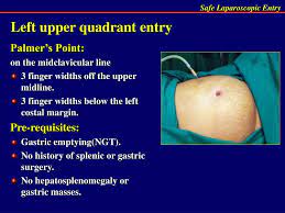 To accurately describe body parts and position, initial reference point and directional terms should be used in a medical setting. Ppt Safe Entry In Laparoscopy Powerpoint Presentation Free Download Id 2208525