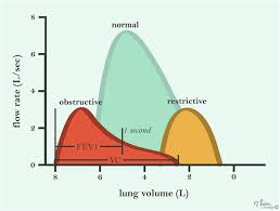 Obstructive Lung Disease Overview Respiratory Medbullets