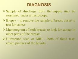 Screening for breast cancer as recommended by a doctor can help detect this condition in its earliest and most treatable stage. Breast Cancer Ppt Download