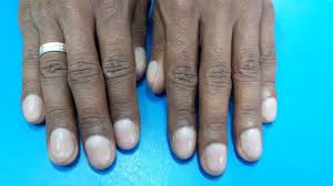 Image result for Digital Clubbing