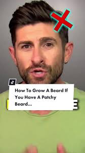 Patchy Beard