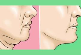 как убрать гиалуроновую кислоту из губ в домашних условиях Kak Ubrat Vtoroj Podborodok I Ukrepit Myshcy Shei Lico Dvojnoj Podborodok Podtyazhka Kozhi