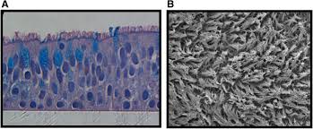 The electron microscope is an extremely expensive and complicated instrument that only research. Rhinovirus Replication And Innate Immunity In Highly Differentiated Human Airway Epithelial Cells Respiratory Research Full Text