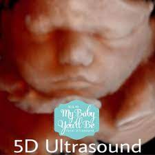 My Baby You Ll Be 3d 4d Fetal Ultrasound Home Facebook