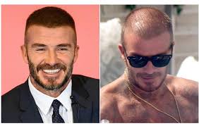 And clearly, the haircut works. David Beckham Chooses Hair Thickening Fibres Biothik