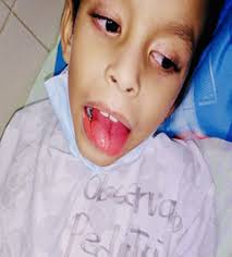 Acta Pediátrica Hondureña, Vol. 11 No.1