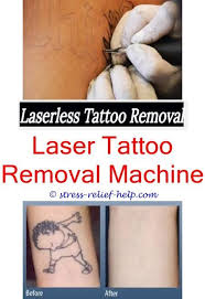 How laser tattoo removal works. Permanent Tattoo Removal Cost How Tattoo Removal Works Tattoo Removal Cream Reviews Uk Tattoo Removal Treatme Tattoo Removal Cost Laser Tattoo Tattoo Removal