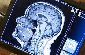 The syndrome begins during childhood and further research into the brain structure of these patients has revealed that they usually show a treatment options and procedures for asperger's syndrome. Children S Brain Scans Unveil Areas That Are Responsible For Perceiving Social Interactions