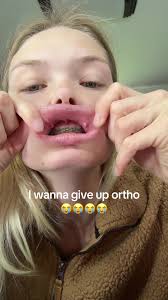 Struggling with Allergic Reactions to Orthodontic Treatments