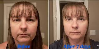 Which is a better cleanser, balance or stimulate?