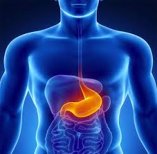 Resultado de imagen para cirugía antireflujo gastroesofagico