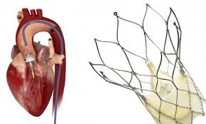 Tavi Fur Jeden Geeignet Healthcare In Europe Com