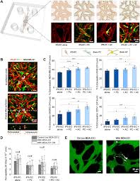 The CCL2-CCR2 astrocyte-cancer cell axis in tumor extravasation at the  brain | Science Advances