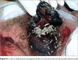 Myasis—by this term (spelled also myiasis, and myiosis), is meant parasitism by dipterous larv. Pdf Unusual Presentation Of The Urogenital Myiasis Caused By Luciliasericata Diptera Calliphoridae Semantic Scholar