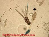 Image result for ALS parasites fungus molds