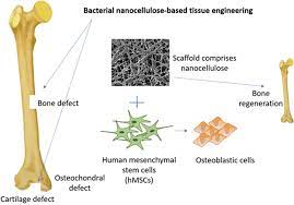 Hrs ministry to please take note of it n grant the minority status. Frontiers Perspective Applications And Associated Challenges Of Using Nanocellulose In Treating Bone Related Diseases Bioengineering And Biotechnology