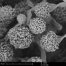 Check spelling or type a new query. The Applications And Practical Uses Of Scanning Electron Microscopes Ata Scientific
