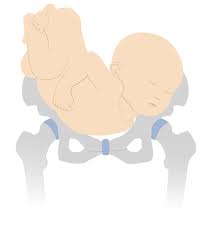 Image result for Shoulder Presentation