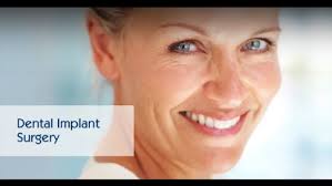 Well, this program is only for the homeless, poor, and disabled people. Dental Implants Orange County Dental Implants Orange Dr Grant