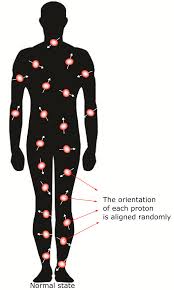 Maybe you would like to learn more about one of these? 6 Protons Orientations In Human Body In A Normal State Each Proton Is Download Scientific Diagram