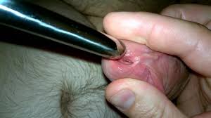 Sounding with 11mm Hegar: Gay Man Porn