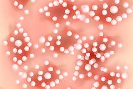 Get helpful info about atopic dermatitis symptoms, causes, and management options. Beware Of Rashes In Covid 19 Patients Medpage Today
