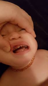 Is it normal for a 5-month-old puppy to lose a tooth?